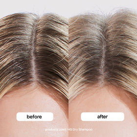 BONDIBOOST before and after root volume comparison showing fuller hair