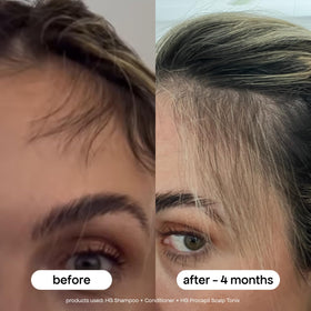 BONDIBOOST styled hair before and after to show fuller appearance