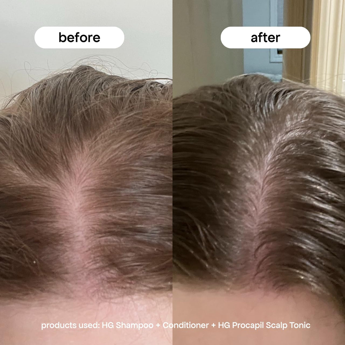 BONDIBOOST applying serum to scalp close-up demonstrating targeted delivery