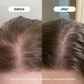 BONDIBOOST applying serum to scalp close-up demonstrating targeted delivery