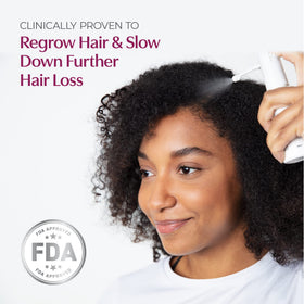 BosleyMD spray applied to scalp showing targeted coverage benefit