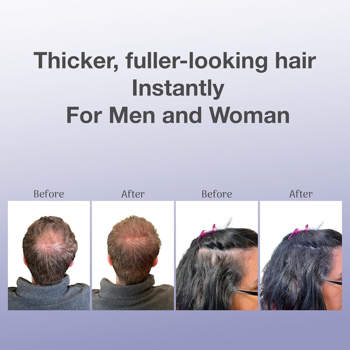 BosleyMD product in hand showing 0.42 oz scale and travel-friendly benefit