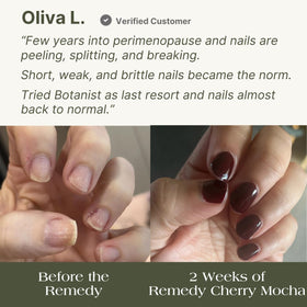 Botanist Nails styled on hands in lifestyle setting showing natural-looking healed nails benefit