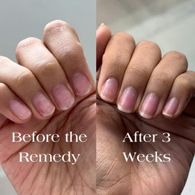 Botanist The Remedy Rose applied on short nails closeup showing strengthened finish