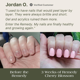 Botanist Nails bottle beside hand for scale showing true product size and convenience