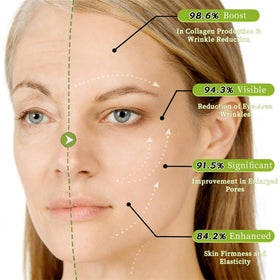 Botoxmix before and after split-face view showing refined pores and smoother skin
