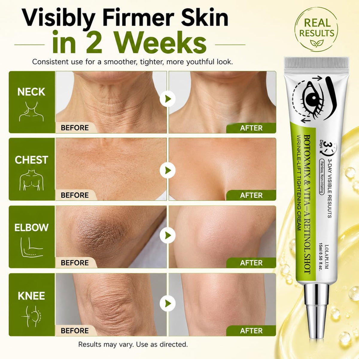 Generic Botoxmix cream on hand demonstrating smooth application and quick absorption