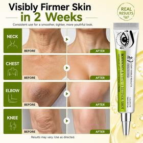 Generic Botoxmix cream on hand demonstrating smooth application and quick absorption