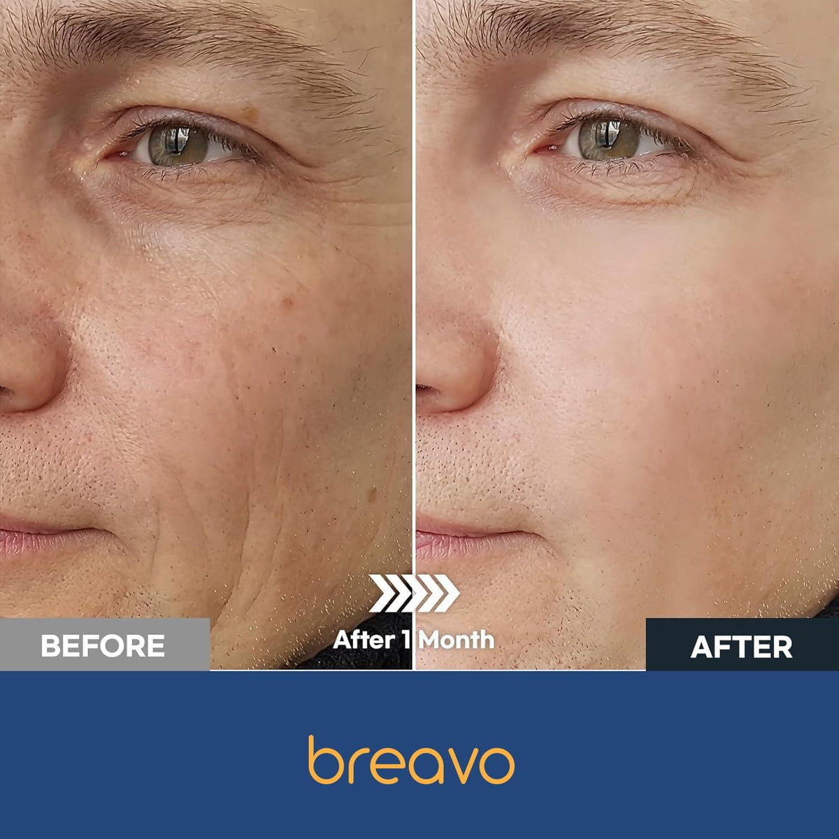 Breavo applied after shaving calming skin and reducing redness