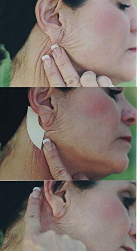 Bring It Up before and after example showing lifted neckline improvement