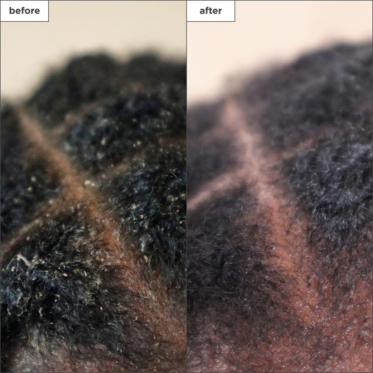 Briogeo binchotan charcoal ingredient close-up demonstrating detox action