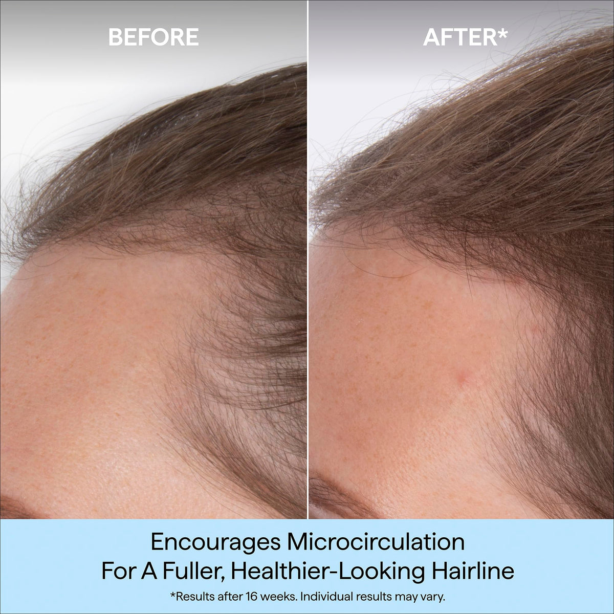 Briogeo dropper dispensing serum for targeted scalp application