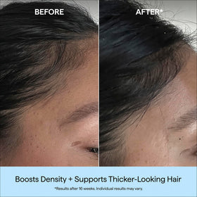 Briogeo applying serum to scalp demonstrating easy massage-in benefit
