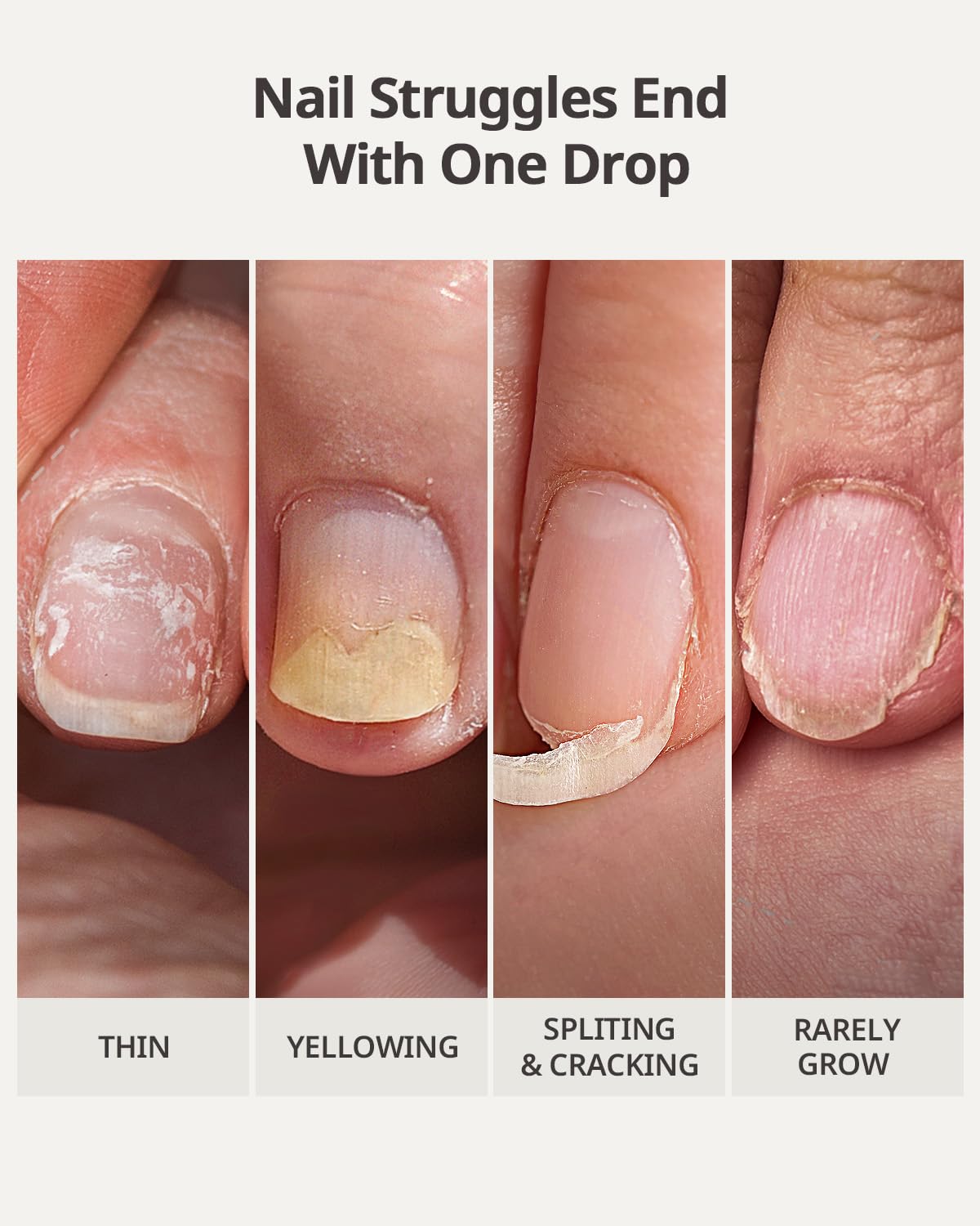 BTArtboxnails before and after nails showing stronger growth benefit