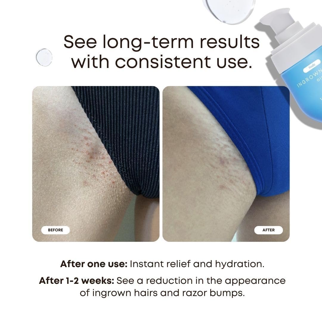Bushbalm bottle open dispensing oil, showing easy application and control
