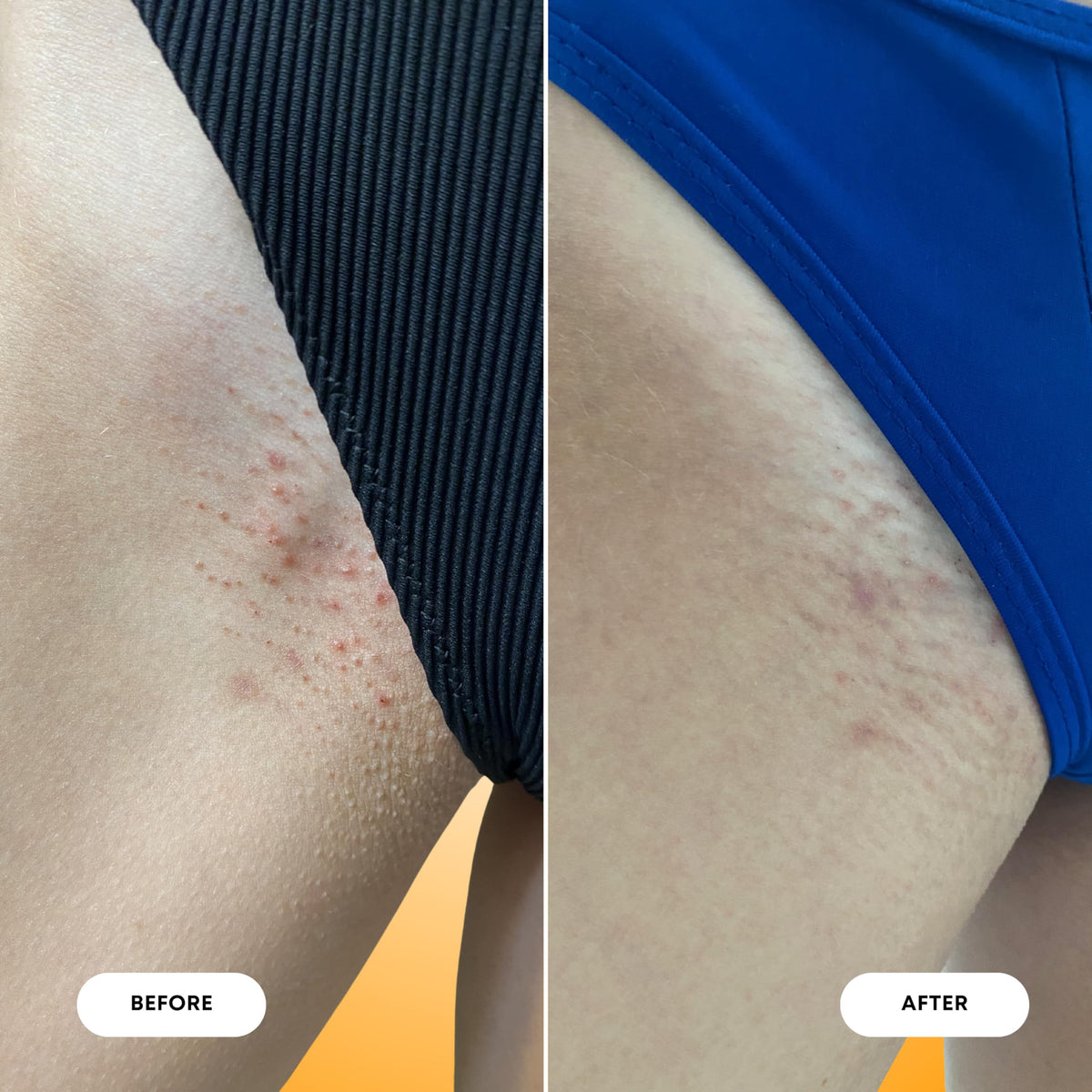 Bushbalm oil absorbing on skin illustrating fast hydration benefit