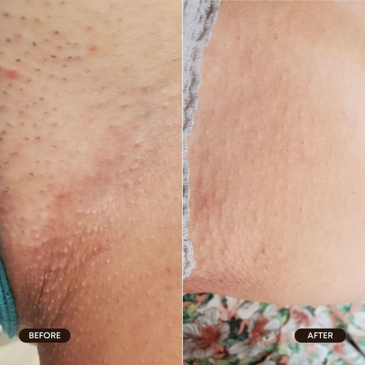 Bushbalm being applied to underarm demonstrating cooling and exfoliation