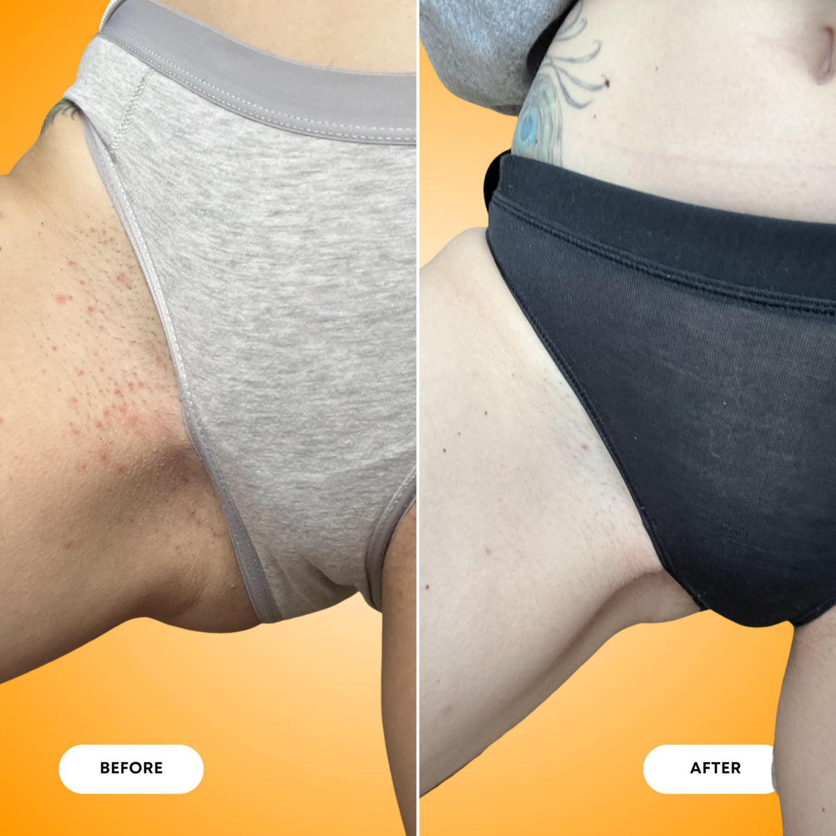 Bushbalm scrub before and after skin showing smoother reduced bumps