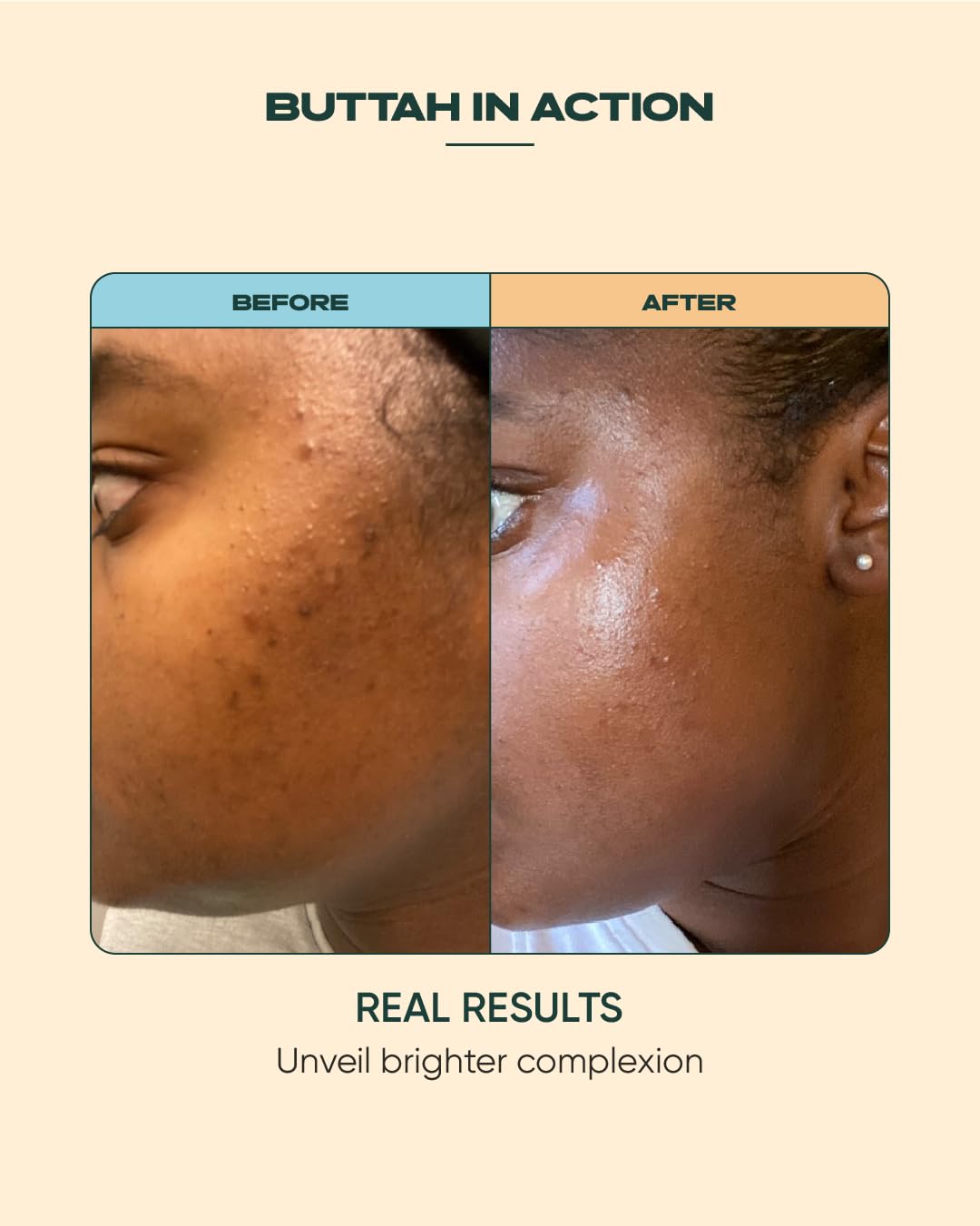 buttah application on cheek showing gentle patting technique and even coverage benefit