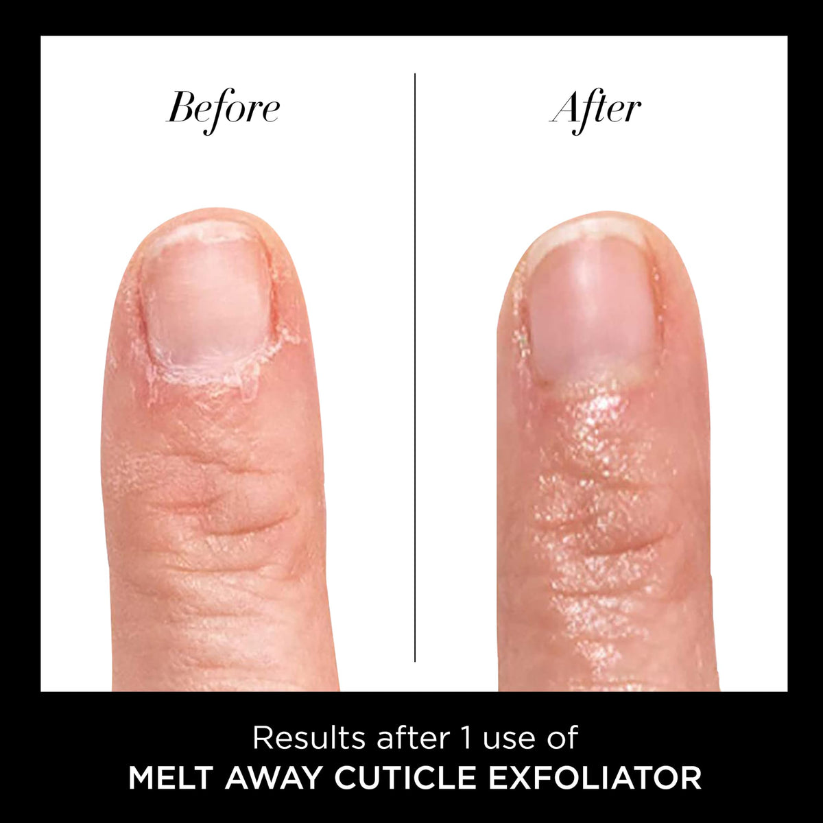 butter LONDON before and after cuticle edges for cleaner nails