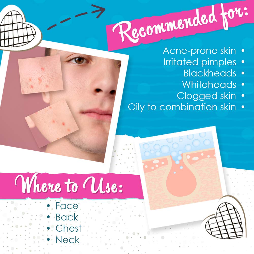 Bye Bye Blemish applied at night on a cotton swab demonstrating targeted overnight treatment