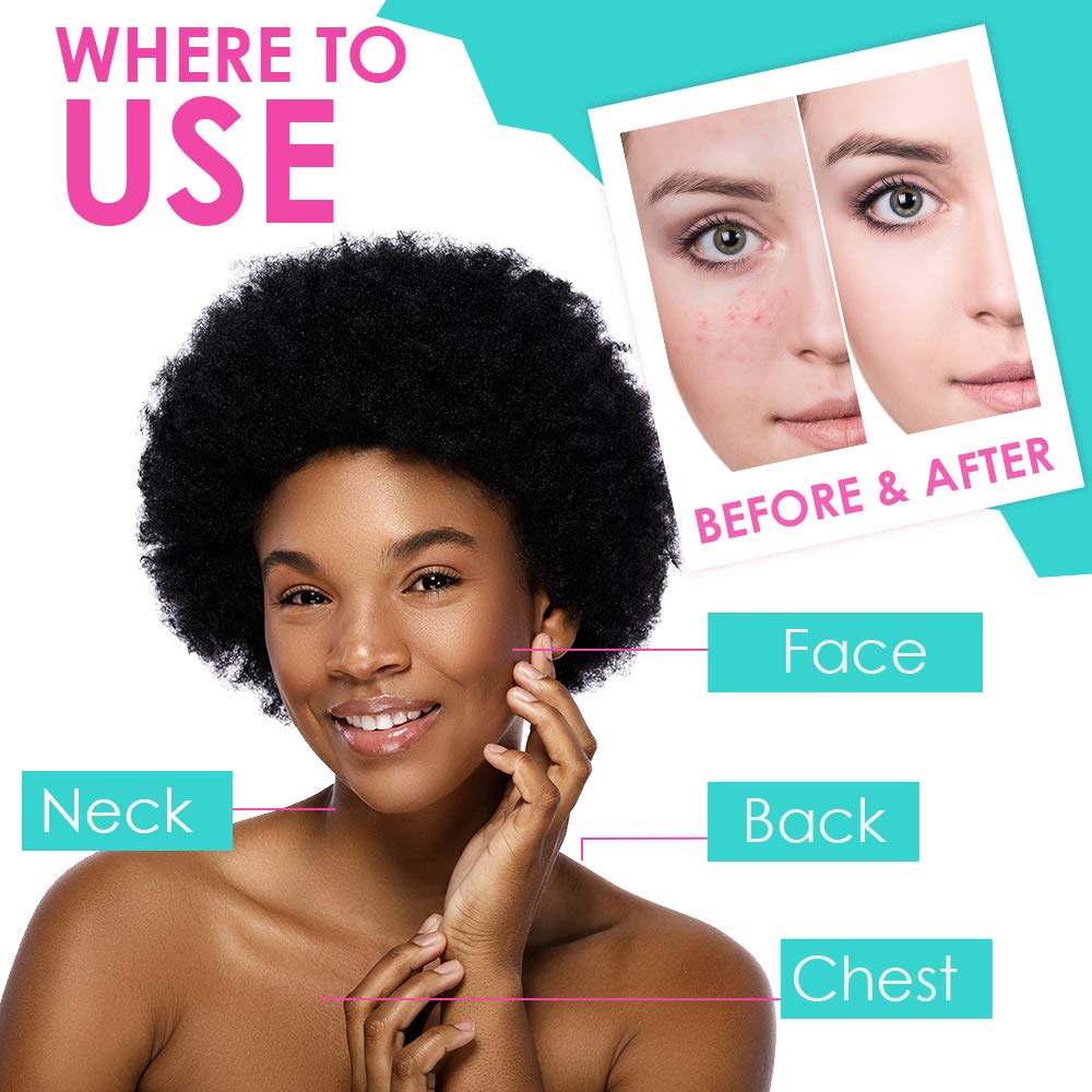 Bye Bye Blemish size comparison in hand illustrating compact 1oz bottle convenience