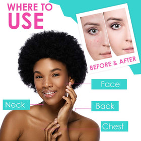 Bye Bye Blemish size comparison in hand illustrating compact 1oz bottle convenience