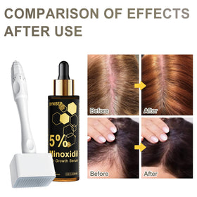 BYNISEP applied to thinning scalp area showing easy topical use