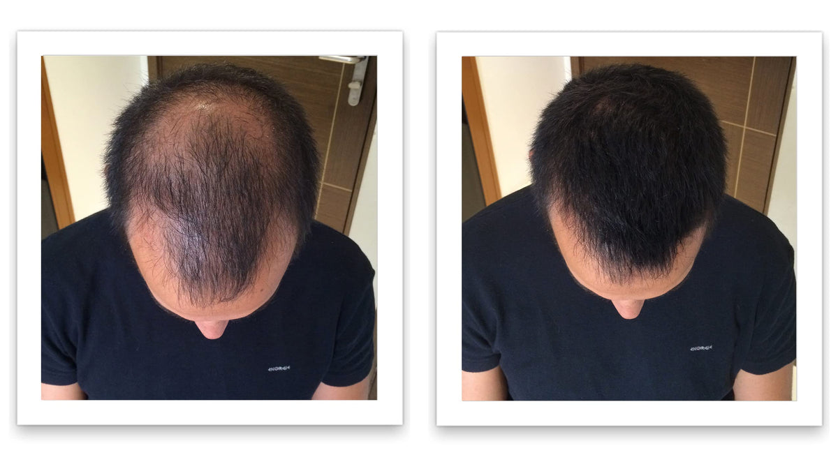 Caboki shampoo washout demonstrating easy removal after use