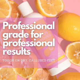 Before and after feet comparison with Cacee showing smoother heels