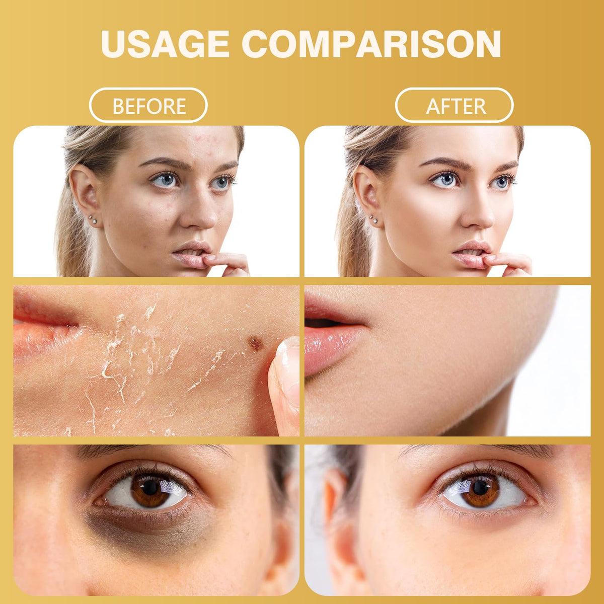 Caderno Inteligente applied to neck and jawline showing targeted tightening benefit