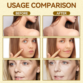 Caderno Inteligente applying cream to neck to smooth fine lines