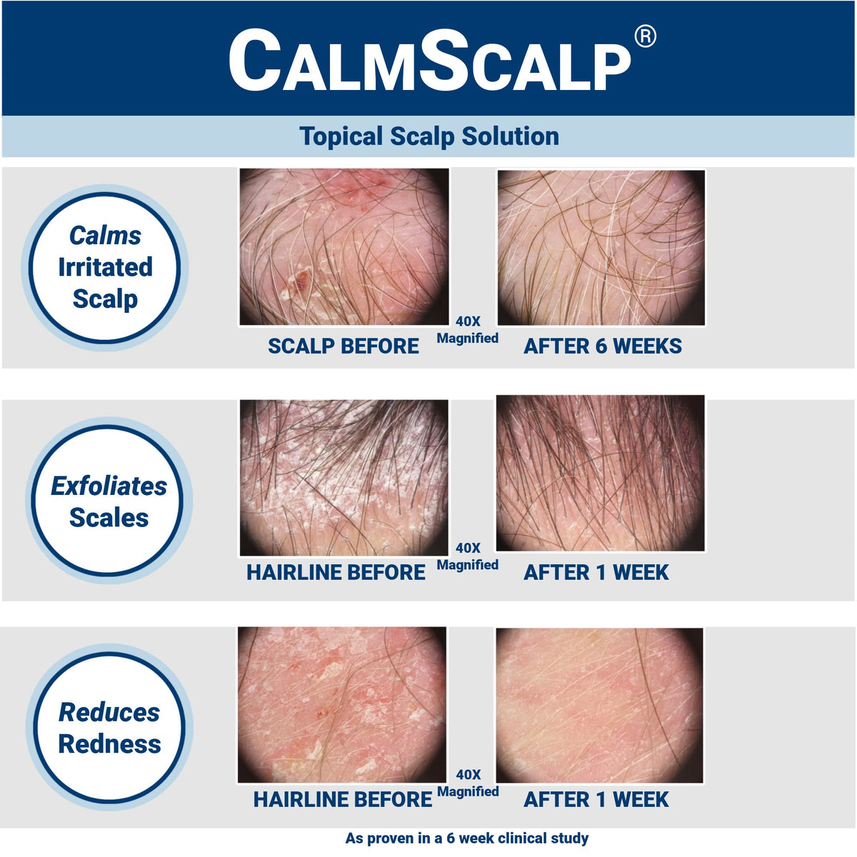 CalmScalp amber bottle close-up, highlights clean design and easy dispensing