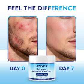 Calvris applied to scalp demonstrating targeted soothing and cooling sensation benefit