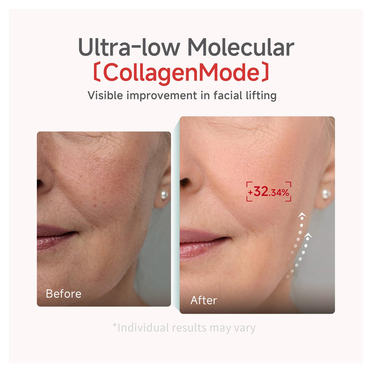 CANDORLOV sheet molded to face showing full facial coverage benefit