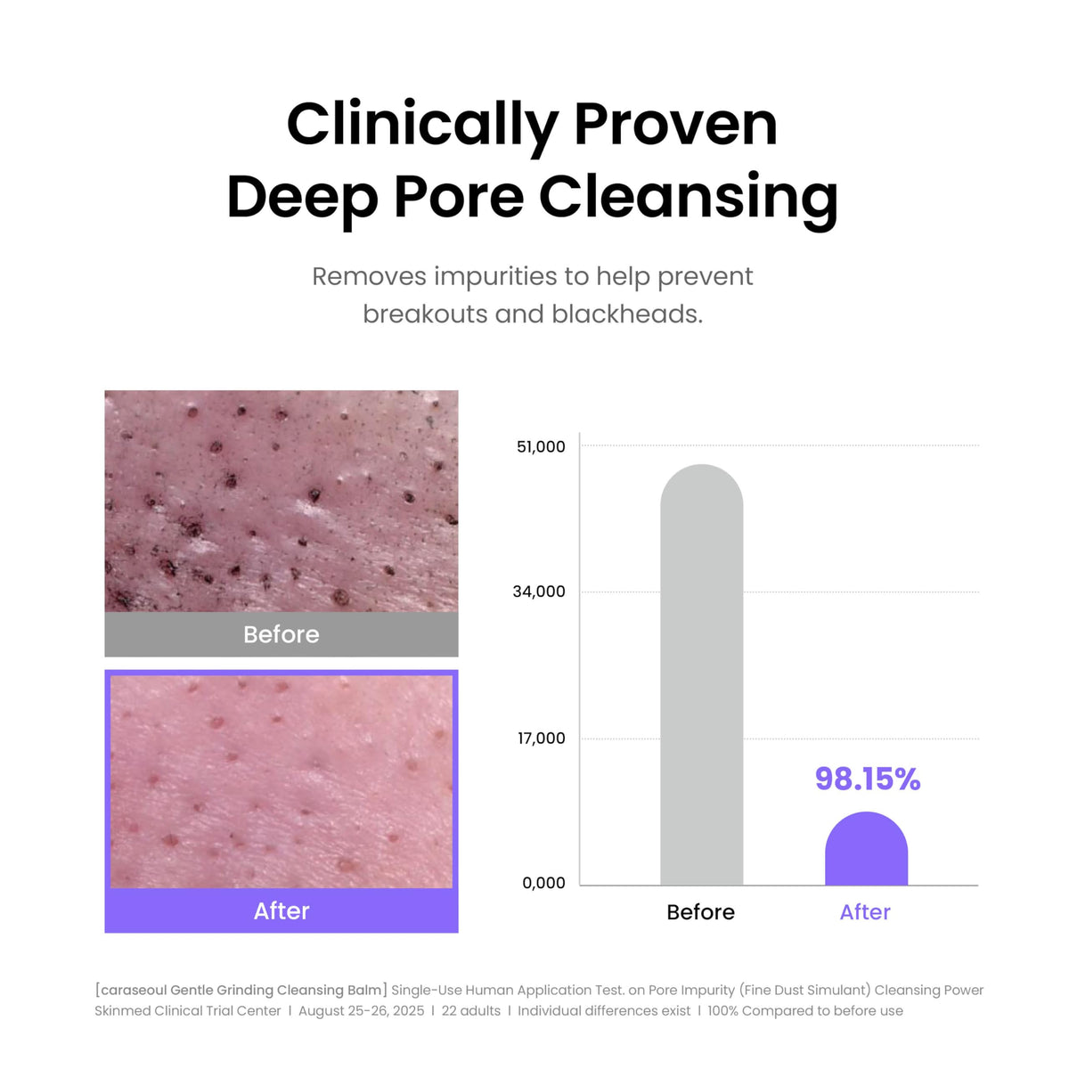 caraseoul applied on face removing makeup with gentle glide
