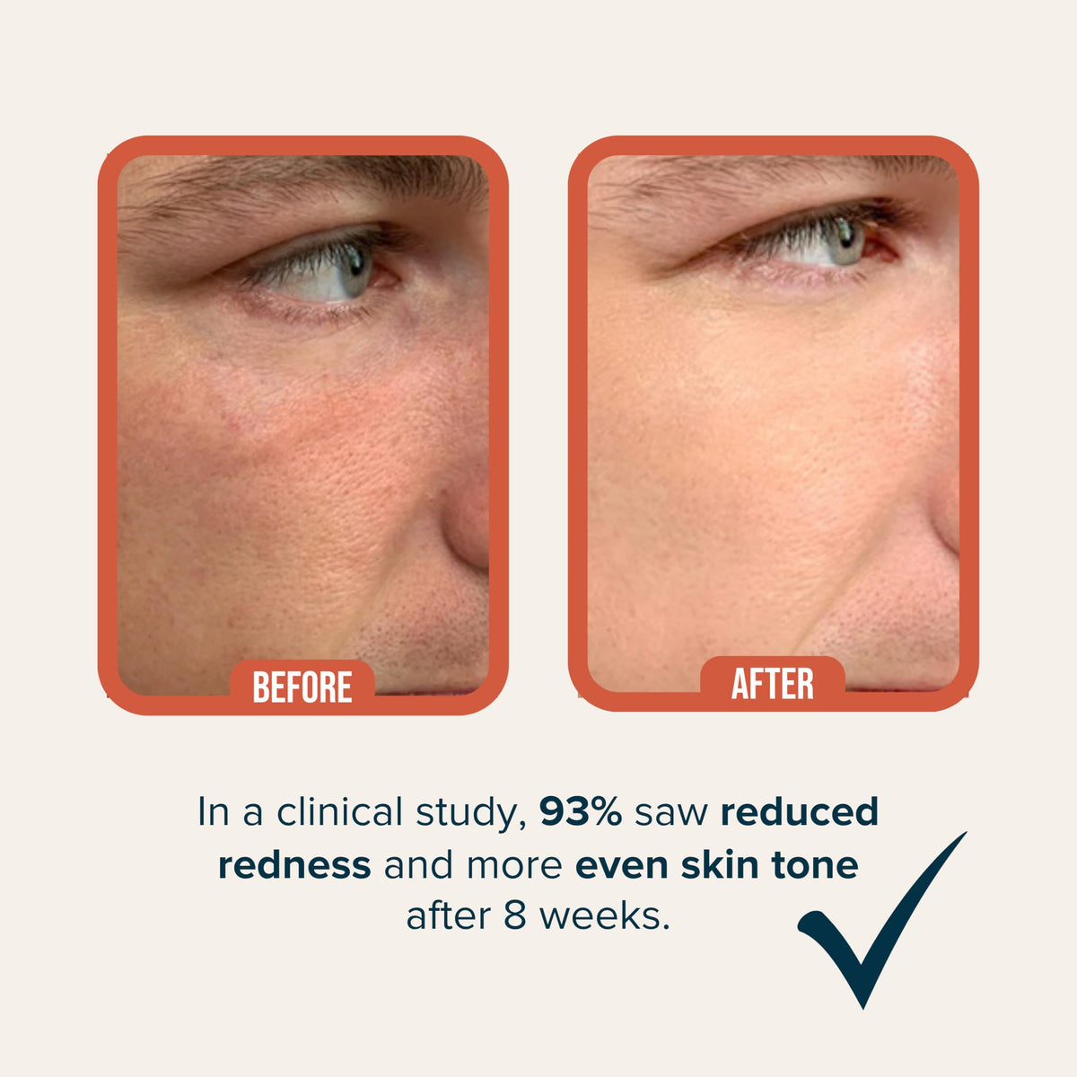 Cardon being applied to male skin showing fast absorption and non-greasy finish