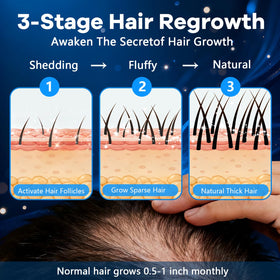CARENICE beard spot treatment in use showing precise application for fuller appearance