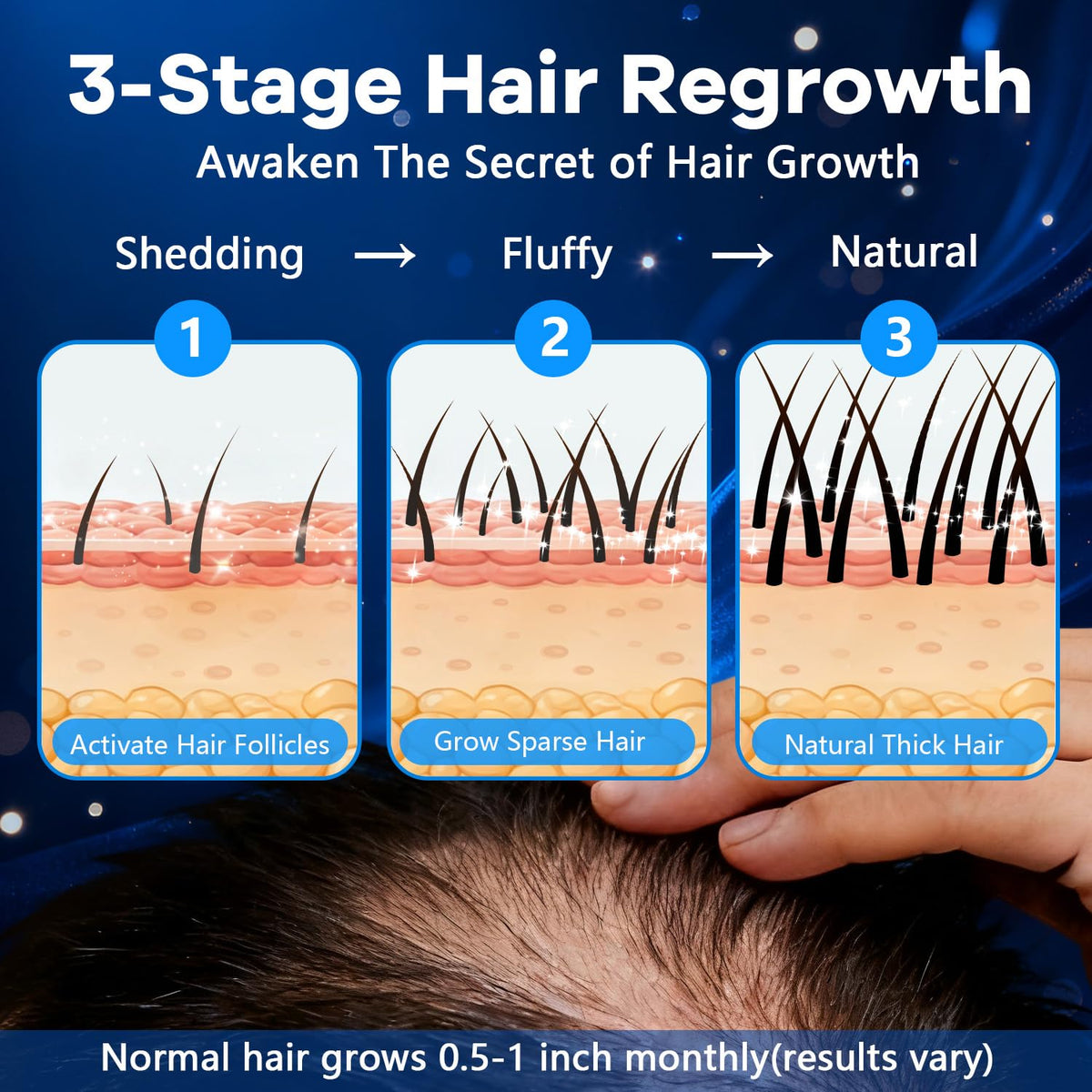CARENICE label close-up listing minoxidil and biotin dosing