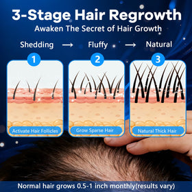CARENICE label close-up listing minoxidil and biotin dosing