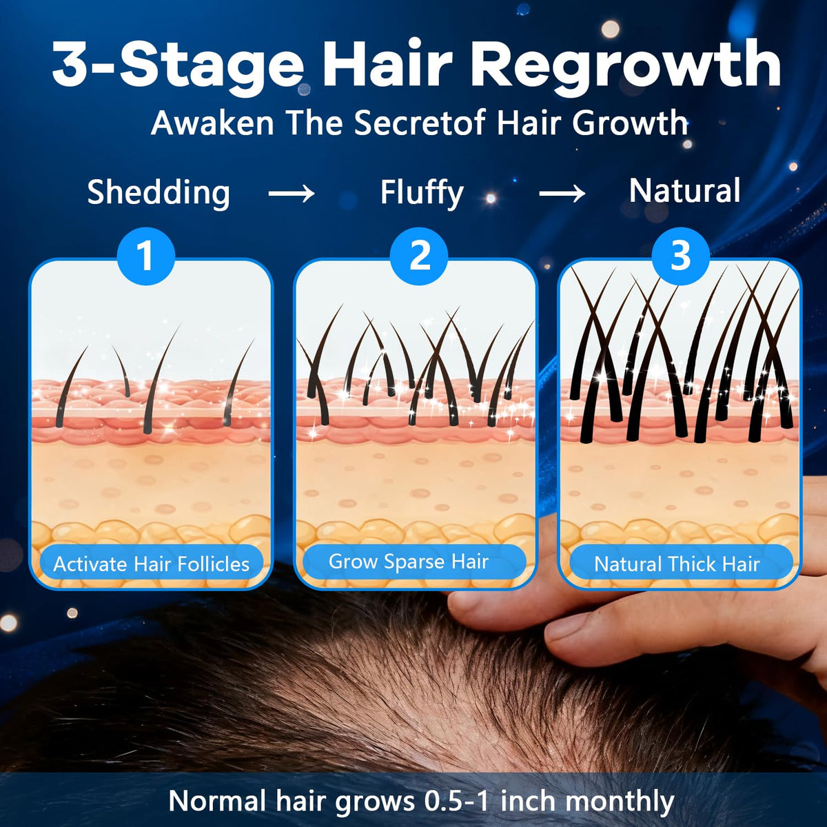 CARENICE foam being applied to scalp demonstrating targeted coverage