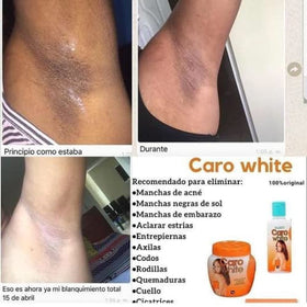 Caro White close-up texture of lotion and cream demonstrating quick absorption and smooth finish