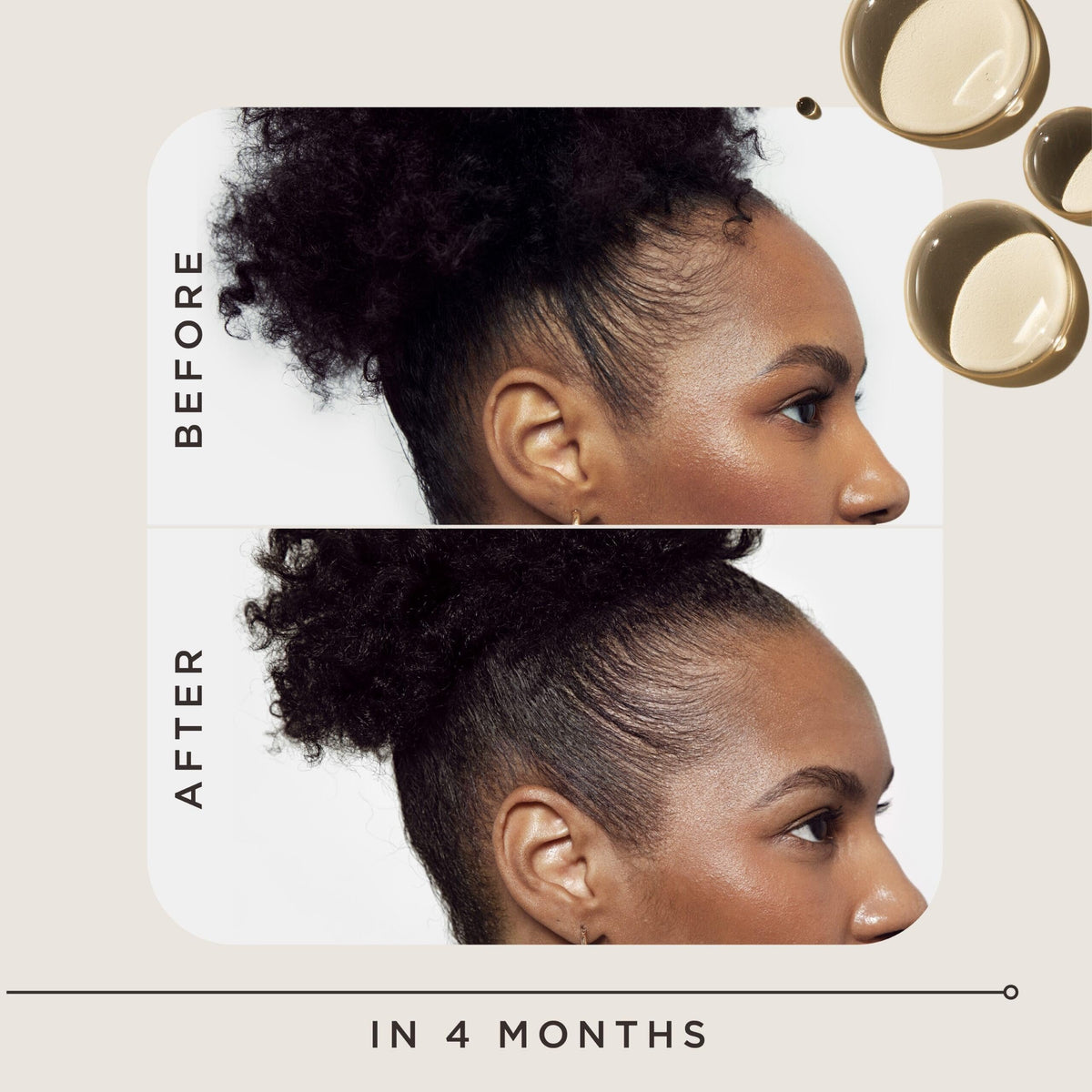 Carol's Daughter ingredient label highlighting 2% minoxidil and formulation details for informed use
