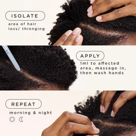 Carol's Daughter scalp application with drops on thinning area demonstrating targeted placement for effectiveness