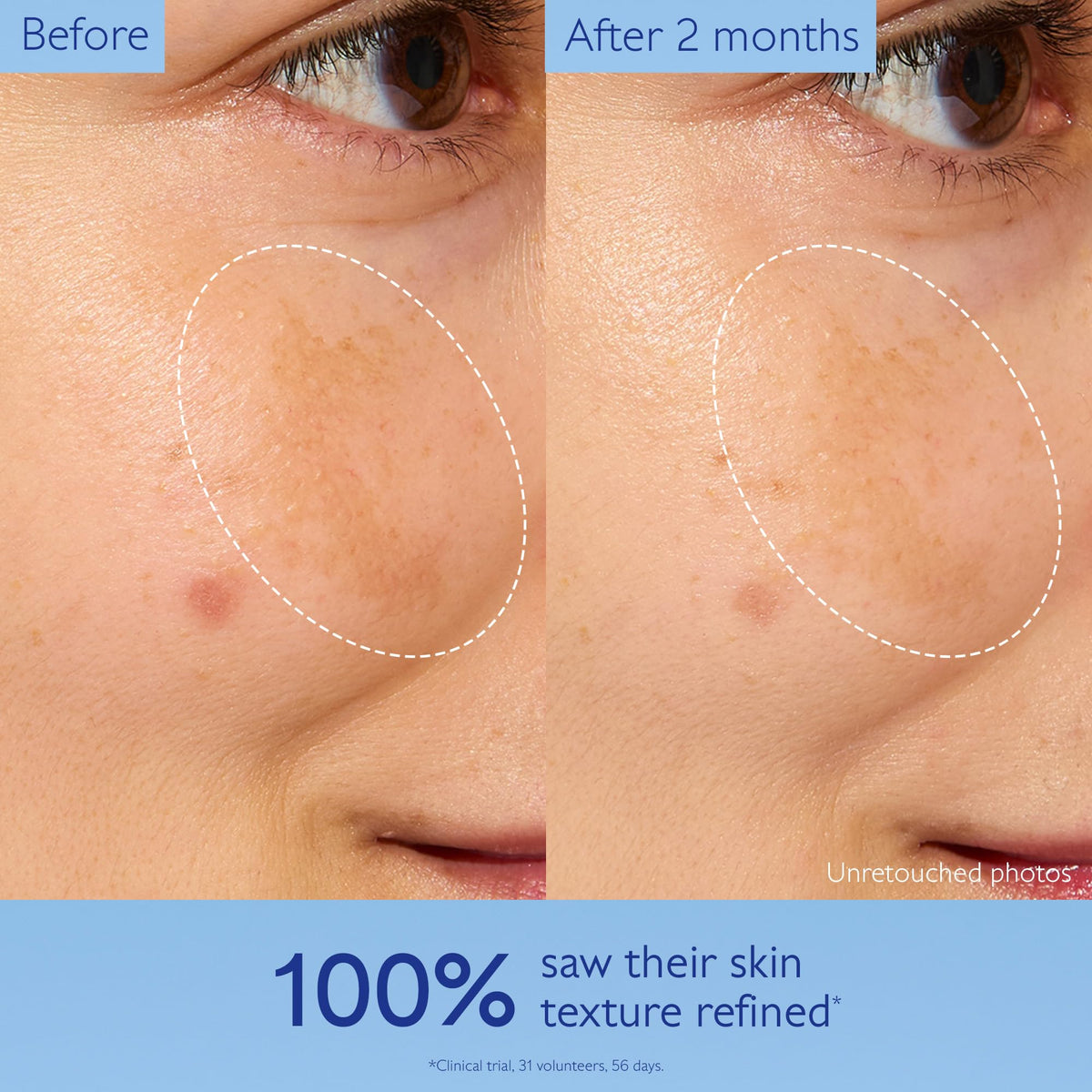 Caudalie essence soaked on a cotton pad for precise application benefit