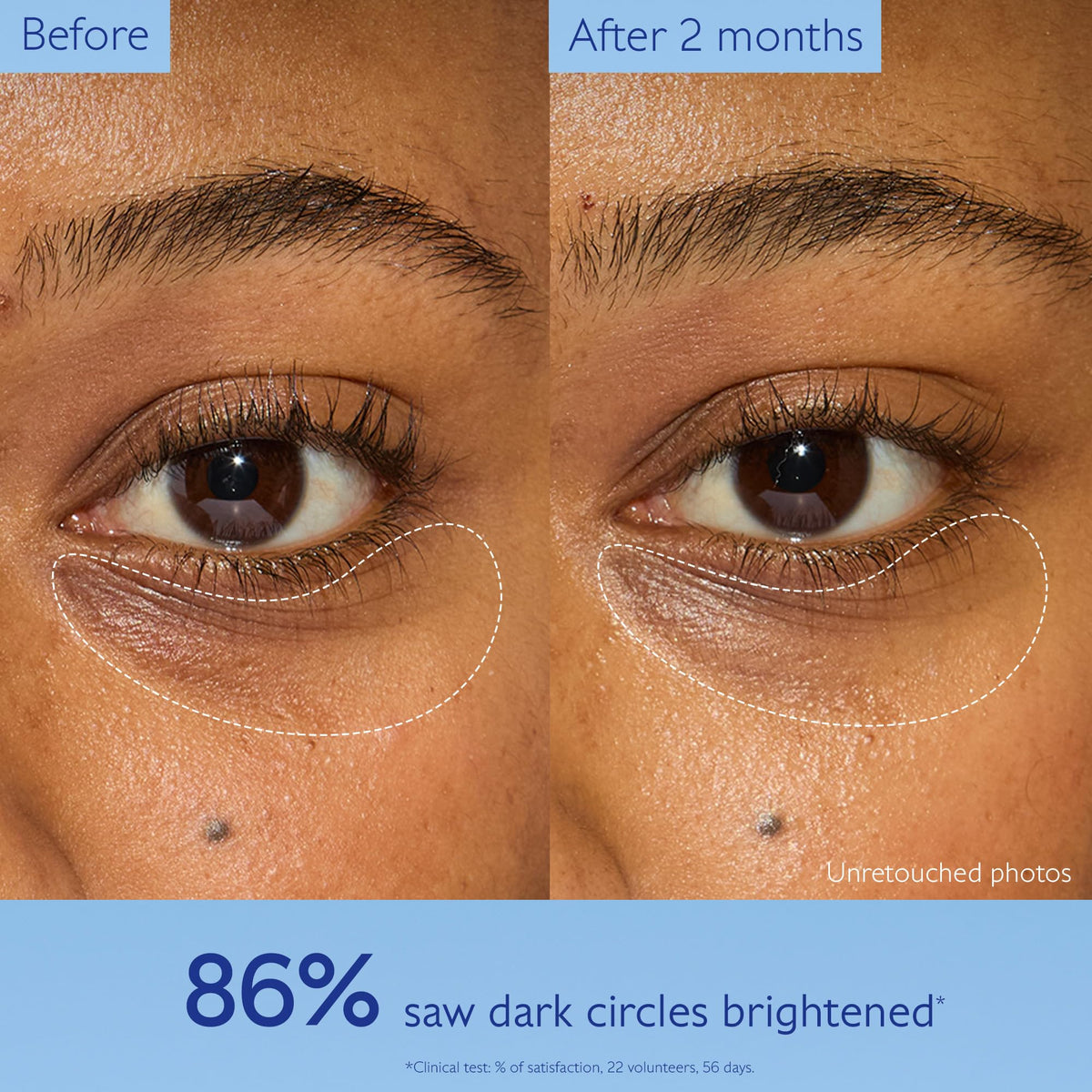 Caudalie niacinamide ingredient visual highlighting brightening support