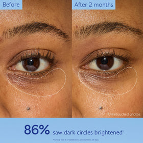 Caudalie niacinamide ingredient visual highlighting brightening support