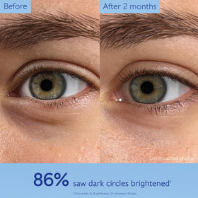 Caudalie viniferine ingredient focus illustrating targeted spot correction