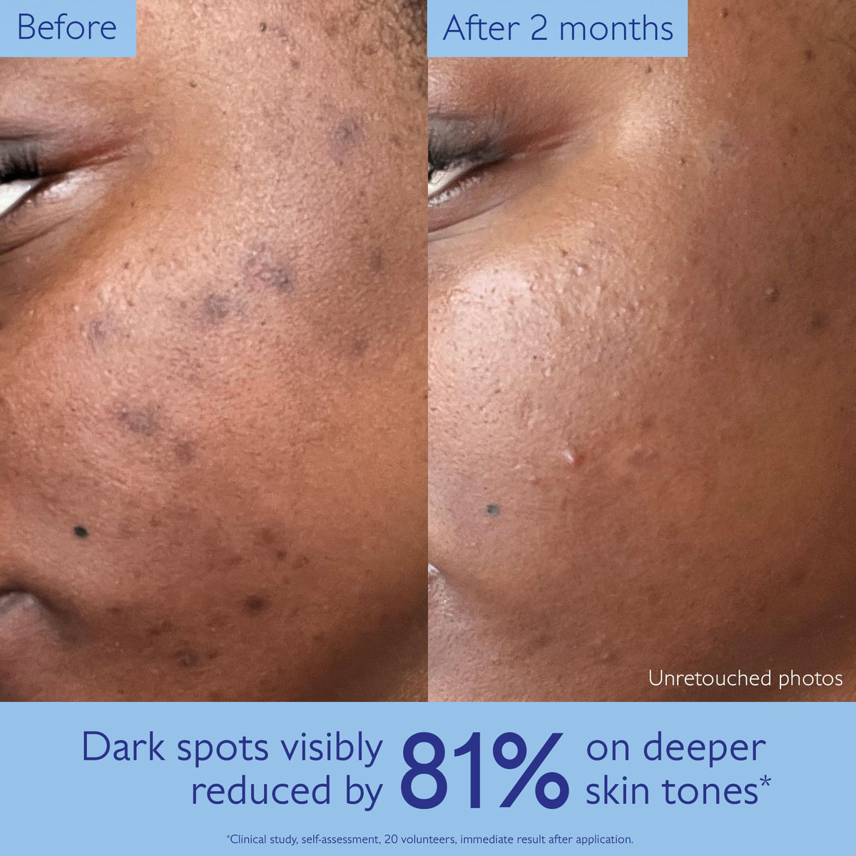 Caudalie Vinoperfect viniferine ingredient visual emphasizing targeted brightening benefits