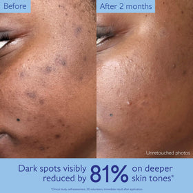 Caudalie Vinoperfect viniferine ingredient visual emphasizing targeted brightening benefits